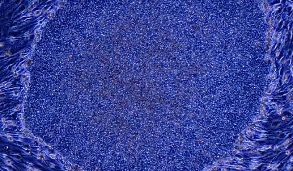 「iPS細胞」再生医療が注目テーマに　関連銘柄へ資金流入